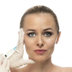 Botox Facial Aesthetics